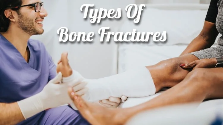 Types of Bone Fractures